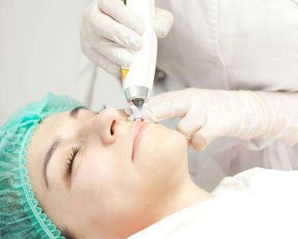 Botox ajkak eljárások, következményei
