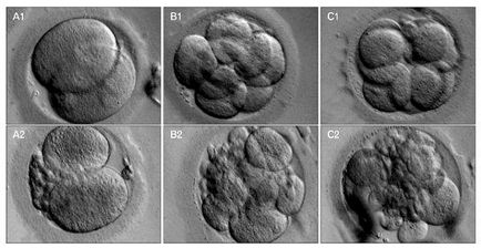 Az embriók minőségét, osztályozás, értékelés átvitelére eco