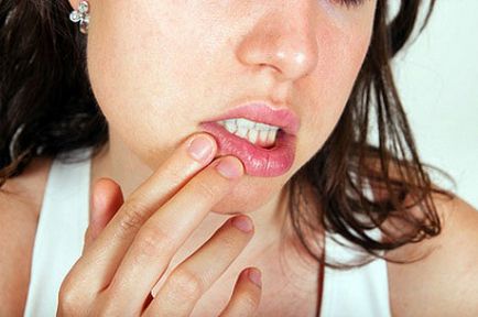 Hogyan kell kezelni herpesz ajkán részletesen megvizsgálták a különböző hatékony eszköze