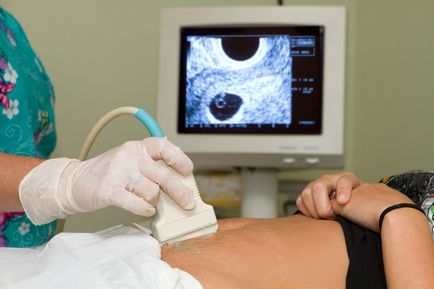 Hogyan lehet azonosítani a méhen kívüli terhesség korai szakaszában a diagnózis és a kimutatási korai szakaszában