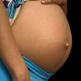 Hogyan húzza a gyomor szülés után, távolítsa el a zsírt, erősíti az izmokat és a bőrt