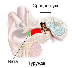 Hogyan kell helyesen tisztítani a fülét kén gyermekek 2-3 év