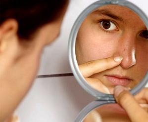 Hogyan lehet eltávolítani a fekete pontok az orr hatékony kezelések