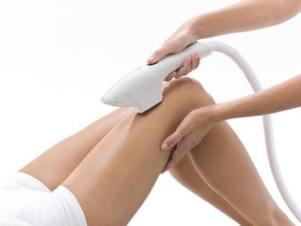 Hogyan lehet eltávolítani a szőr a lábakon leírása a fő módszerek