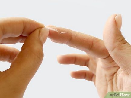 Hogyan lehet eltávolítani a pillanatragasztó a kézről