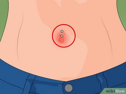 Hogyan törődik egy köldök piercing