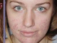 Hogyan, hogy összehangolják az arcod összehangolás módszerek megkönnyebbülést az arcán