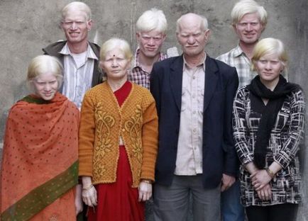 Hogy vannak a 7 legbizarrabb családok a világ - egy igazán egyedi család!