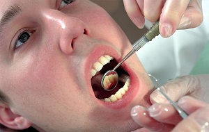 fognyak kipreparálást az okok és a kezelés otthoni és fogorvosi