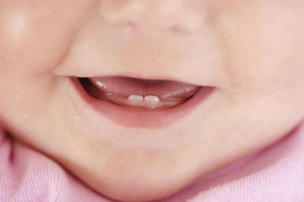 Az első fogak a gyermek, ha vannak tünetek, mit kell tenni