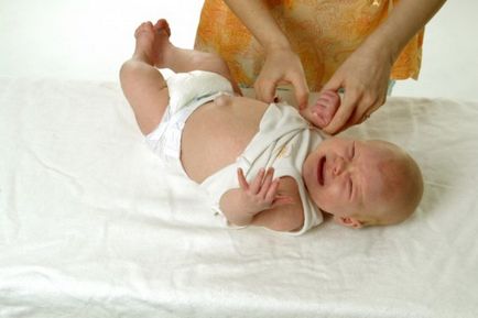 Köldöksérv az újszülöttben okai, tünetei, kezelése