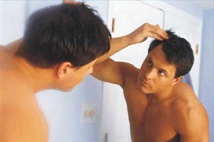 Hátráló hajszálrepedés a férfiak homlokára okait és módszereket, hogy megszabaduljunk a hajhullás