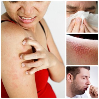 Allergia víz - az, hogy az ilyen okok, tünetek, kezelés