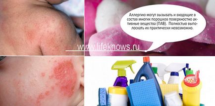 Allergia gyermekeknél mosópor, a kezelés és a tünetek - a magazin