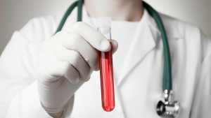 Elemzés a vér biokémiai találkozó, előkészítése, az eljárás és a dekódolási eredmények a tanulmány