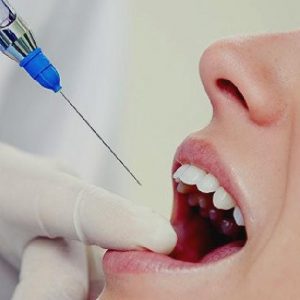 Fájdalomcsillapítás a fogorvosi variációk, javallatok, ellenjavallatok, modern