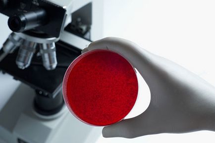 Biokémiai vizsgálatok vér