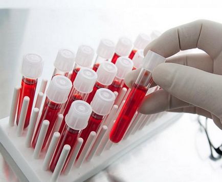 Biokémiai vizsgálatok a vér egy véna, hogy ez azt mutatja, és mi megy bele
