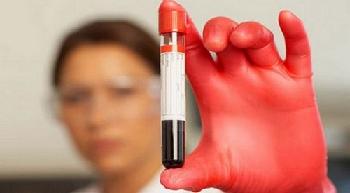 Biokémiai vizsgálatok a vér és a sebesség a dekódolási eredmények felnőtteknél