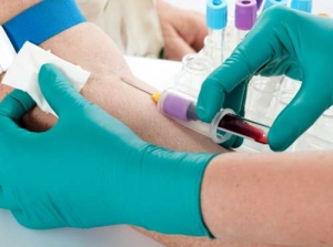 Biokémiai vizsgálatok a vér - a norma, megfejteni a biokémiai vizsgálatok a vér