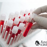 Biokémiai vizsgálatok A vércsoport - egy teljes tanulmány egy organizmus