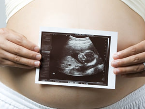 Mi fetometry gyümölcs, és komponenseként asztal indexek hétre terhesség