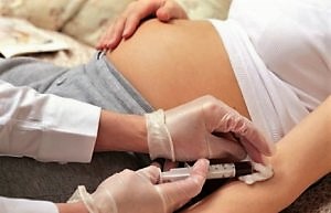 D-dimer emelkedett - okok, melynek mértéke a terhesség hétről-hétre, a mutatók táblázata, cardio ellátás