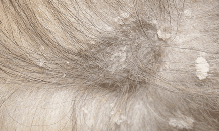 Dermatitis macskák fotó tünetek és a kezelés