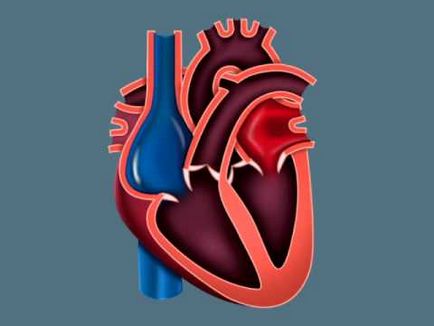 Sematikus szív tengely eltérés a helyzet a függőleges és vízszintes