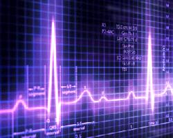 Az EKG megmondani, hogy mi az eredménye az EKG Orvosi portál „”