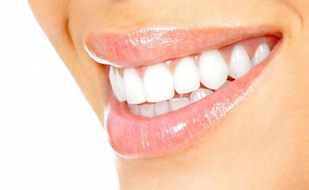 Milyen gyorsan és milyen fehéríti a fogakat otthon - bevált módszerek