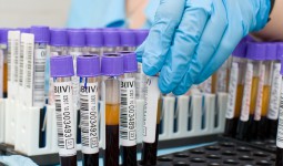 Mi betegségek határozza meg a biokémiai vizsgálatok a vér