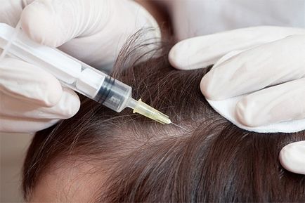 Hogyan lehet megszabadulni a szürke haj kozmetikai és népi jogorvoslati