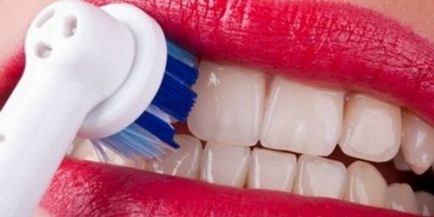 Hogyan fehéríti a fogakat otthon hatékonyan és károsodás nélkül