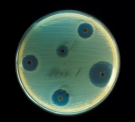 Hogyan Staphylococcus aureus