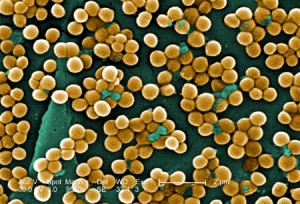 Hogy a Staphylococcus aureus fertőzés 4. megvalósítás