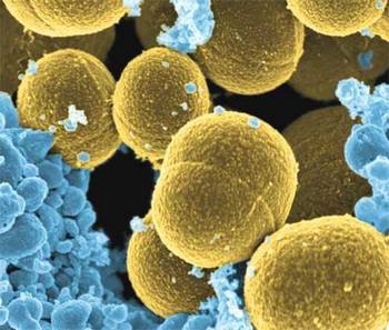 Hogy a Staphylococcus aureus - megelőző intézkedések