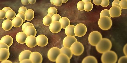 Hogy a Staphylococcus aureus fertőzés az emberi gyermekek és felnőttek