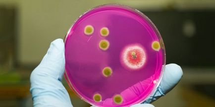 Hogy a Staphylococcus aureus fertőzés az emberi gyermekek és felnőttek