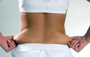 Hogyan lehet eltávolítani a zsírt a hasa és az oldala egy integrált megközelítés