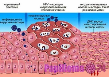 Hogyan lehet eltávolítani a vírusokat és trójai a számítógépről