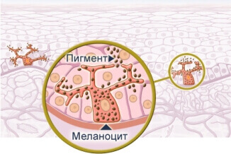 Hogyan orvosolni a melanin a szervezetben