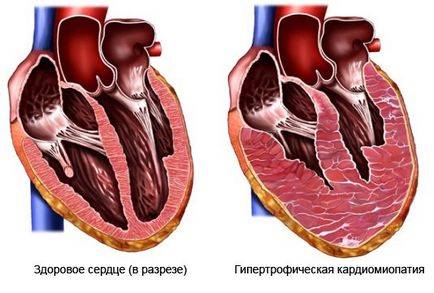 Cardio a szív, kardió edzés a szív, a szív, hogy megerősítse a szív, kardió edzés