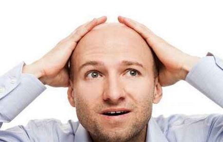 Kopaszság kezelésére, alopecia férfiaknál népi jogorvoslati