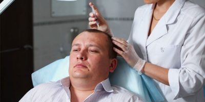 Kopaszság kezelésére férfiaknál diagnózis és hatékony módszerekkel foglalkozó alopecia