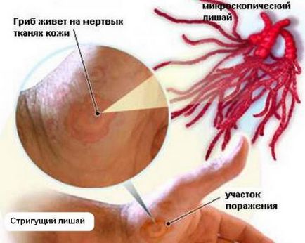 Gyógyszerek megfosztva egy személy, megfosztva típusú, tünetek és diagnózis módszerei