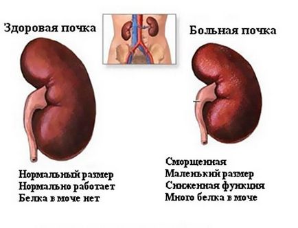 Vizelet vér férfiak okoz vozmozhnvye