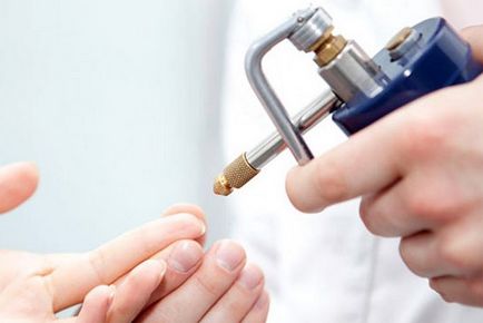 Lehetséges, hogy távolítsa el papilloma a test és attól, hogy az ehhez szükséges Lehetséges, hogy távolítsa el papilloma a test és attól, hogy az ehhez szükséges