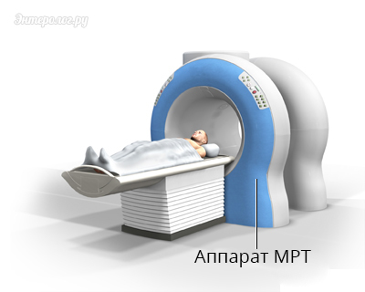 MRI a has, amely megmutatja, hogyan kell elkészíteni