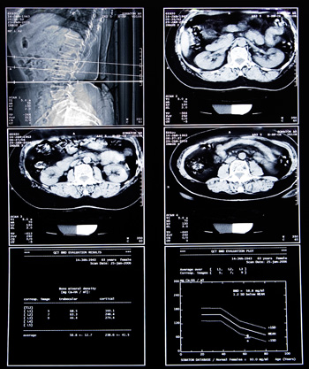 MRI a has - a készítmény és a költségek MRI a belső szervek a hasüregbe